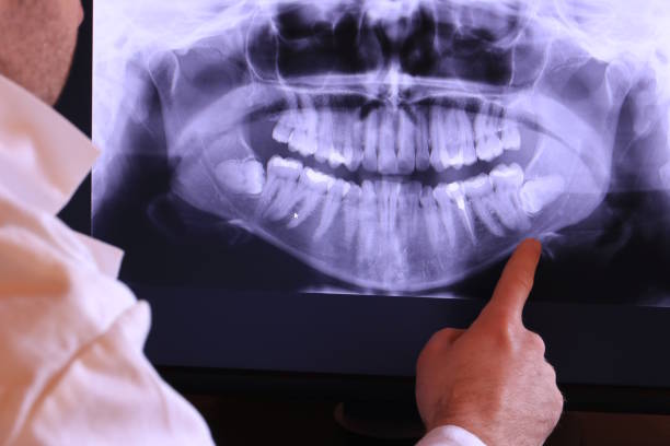 Best Mobile Emergency Dentist in San Bernardino, CA